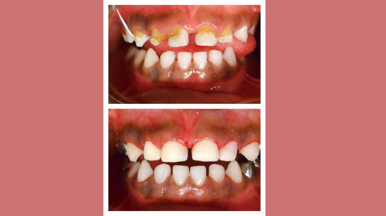 Dentistry for Children