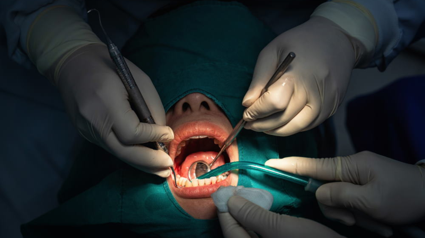 Oral and Maxillofacial Surgeries