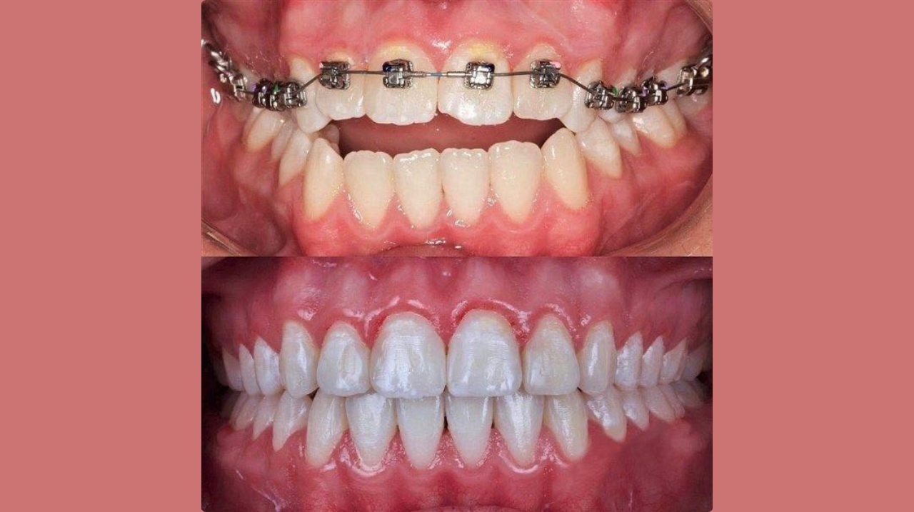 Orthodontics